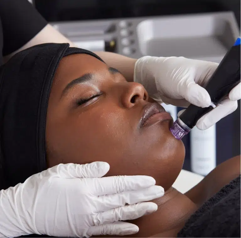 hydrafacial alestetics